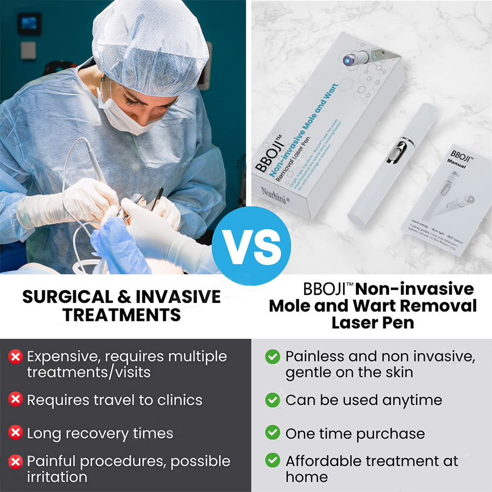 BBOJI™ Non-invasive Mole and Wart Removal Laser Pen