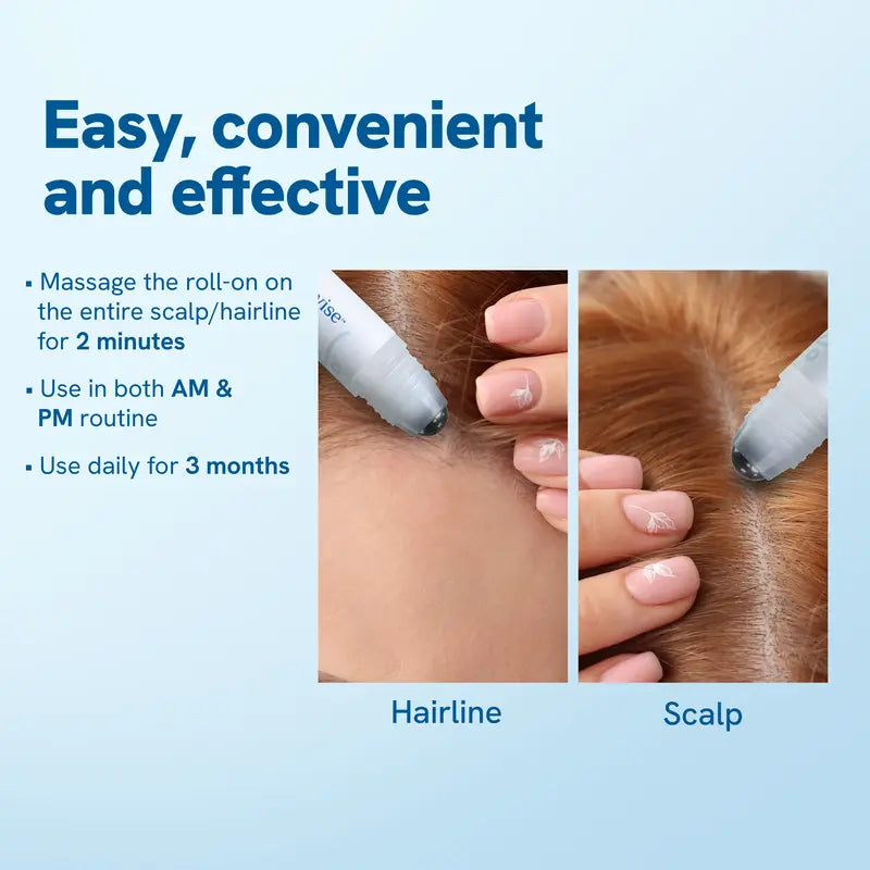 🔥 Final 3 Hours: 60% OFF Hair Growth Roll-On Serum – See hair growth in 4 weeks