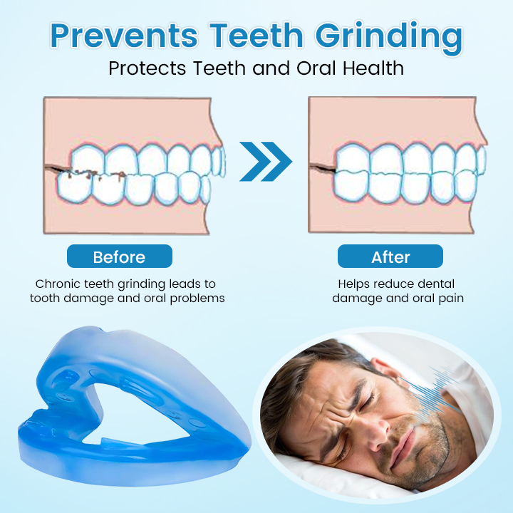 🌙GIVE YOU A GOOD NIGHT'S SLEEP 🦷 QIAWI™ Anti-Snoring Guard 🔵✨