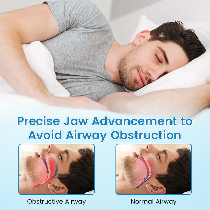 🌙GIVE YOU A GOOD NIGHT'S SLEEP 🦷 QIAWI™ Anti-Snoring Guard 🔵✨