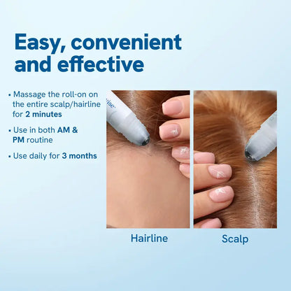 🔥 Final 3 Hours: 60% OFF Hair Growth Roll-On Serum – See hair growth in 4 weeks