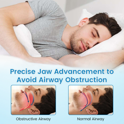 🌙GIVE YOU A GOOD NIGHT'S SLEEP 🦷 QIAWI™ Anti-Snoring Guard 🔵✨